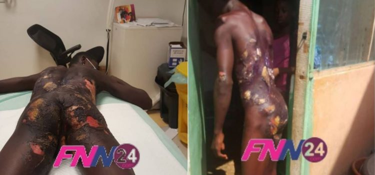 mother pours hot water on son's body